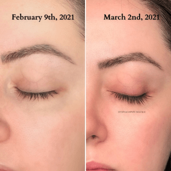 Before and After 1