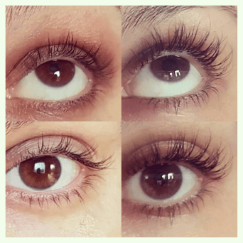 Before and After 2