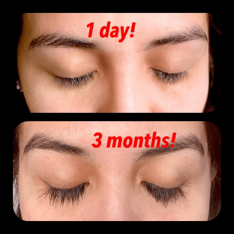 Before and After 3
